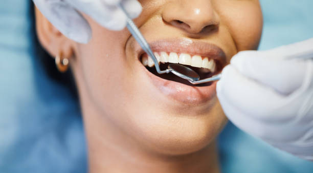 Best Emergency Dental Care for Abscessed Tooth in Wakeeney, KS